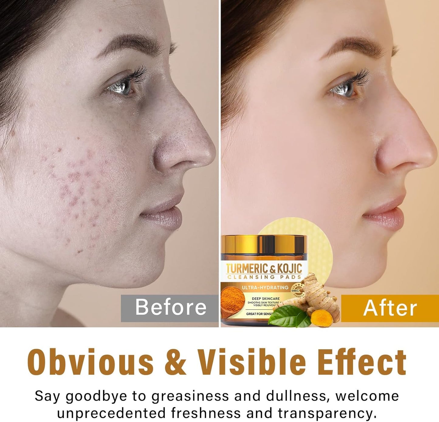 Turmeric Kojic Acid Pads – Brightening Daily Exfoliating Skincare for Radiant Skin