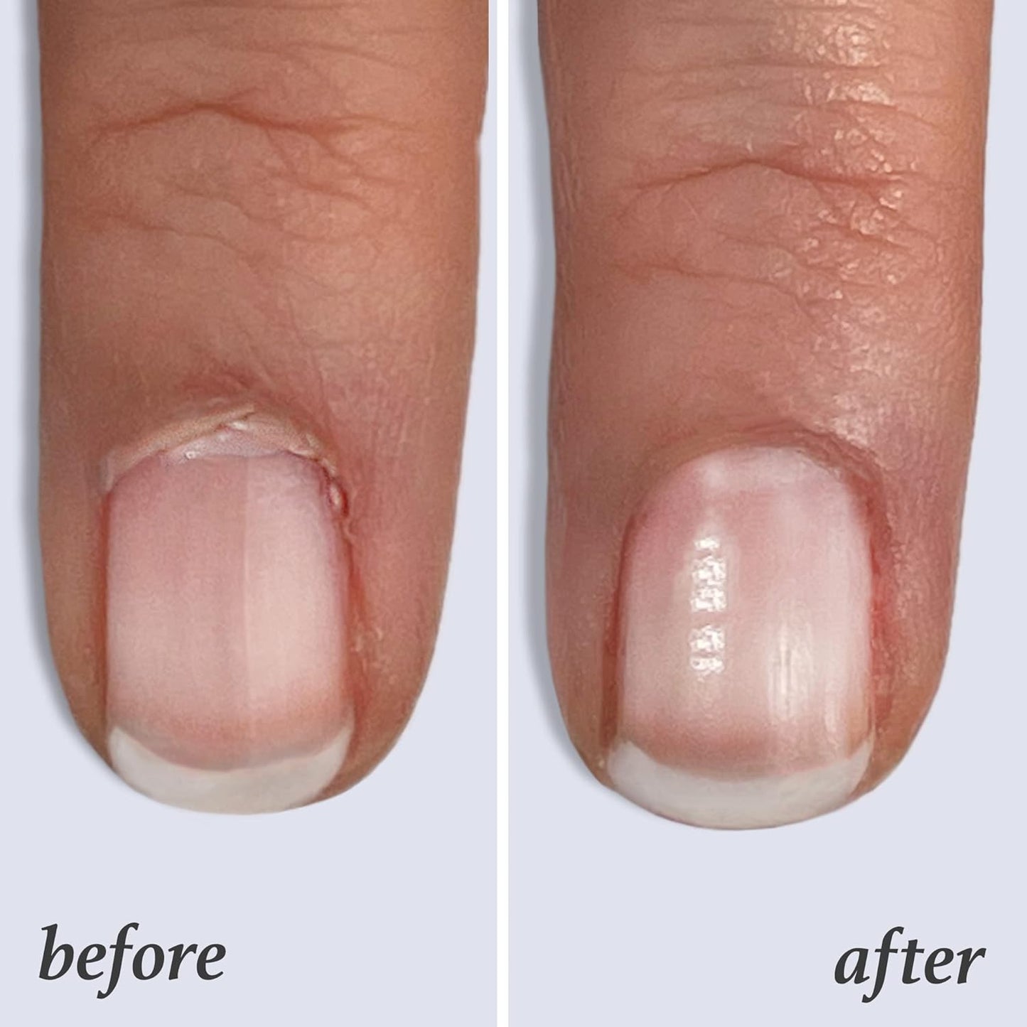 Julep Essential Cuticle Oil Treatment – Hydrating Vitamin E Cuticle Oil, Rollerball