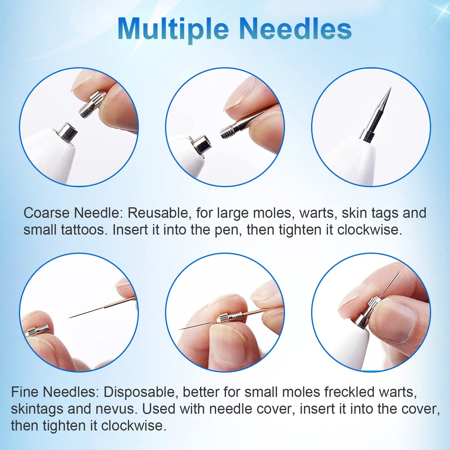 Skin Tag Remover Pen Rechargeable 9 Level with LED Spotlight